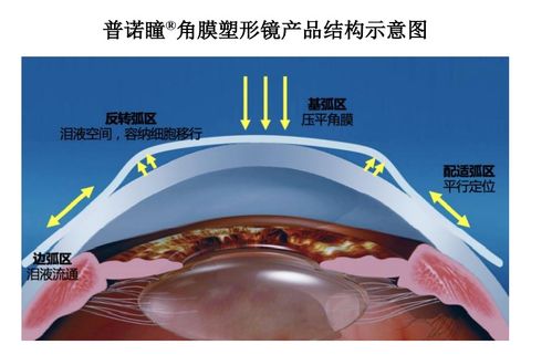 眼科新銳愛博醫療 技術先鋒的全球化征程
